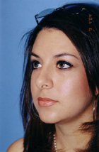 Rhinoplasty Before & After Patient #4803